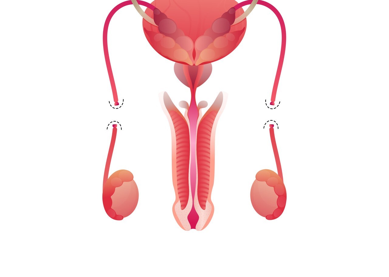 Postectomia e vasectomia - Dr. Marcos Paulo Carneiro